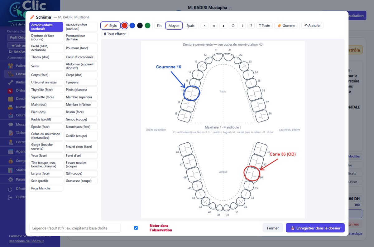 Schéma des arcades dentaires à annoter