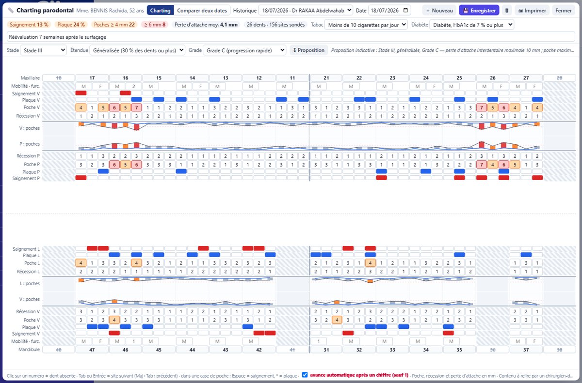 Charting parodontal sur six sites par dent avec indices